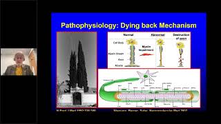 FPN Webinar Hereditary Neuropathies amp Genetic Testing featuring Florian Thomas MD PhD [upl. by Charlie130]