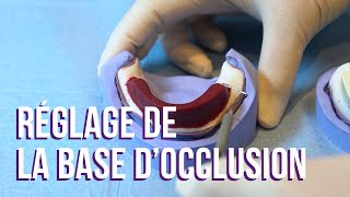 Tuto Prothèse 1 – Le réglage de la base d’occlusion [upl. by Jemmy]