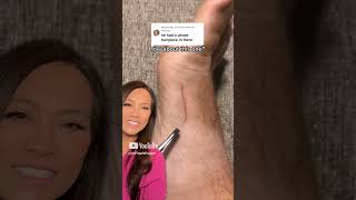 Dr Pimple Popper Reacts to Inflamed Ingrown That Looks SATISFYING to Pull Out [upl. by Cacilia]