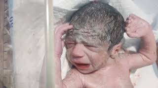 Newborn baby after delivery with vernix caseosa on body newvideo newborns babies delivery [upl. by Innek565]