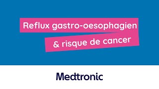 Reflux gastrooesophagien amp risque de cancer associé [upl. by Perloff]