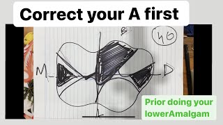 ADC Amalgam task principles Learn your A first prior doing your Lower Amalgam [upl. by Yates]