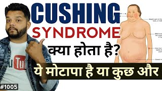 कसिंग सिंड्रोम क्या होता है  Cushings Syndrome Symptoms Treatment [upl. by Yecac]