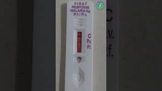 Malaria rapid diagnostic test  Malaria antigen test  Maleria test  plasmodium MP [upl. by Franklin]