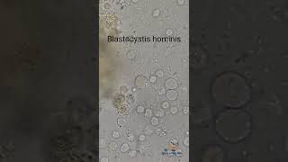 Blastocystis hominis in Stool [upl. by Wilmar]