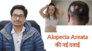 Alopecia Areata की नई दवाई  Tofacitinib  Baricitinib  Ruxolitinib  गंजापन का नया इलाज़ alopecia [upl. by Falconer]