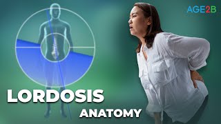 Fast Fix for Lumbar Lordosis  Overview Symptoms Causes Treatment Prevention And Diagnosis [upl. by Nylsor]