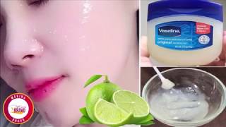 Vaseline with Lemon remove the spots and have Perfect Skin [upl. by Euginomod]