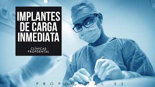 Cirugía de la colocación de implantes carga inmediata [upl. by Tdnerb]