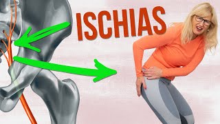 Ischias Übungen ✅ Meine 2 besten Übungen bei Ischias Schmerzen [upl. by Legnaesoj909]