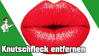 Knutschfleck wegbekommen – 9 einfache Möglichkeiten 💋 [upl. by Okeim342]