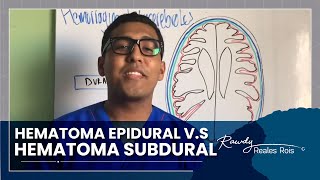 HEMATOMA EPIDURAL VS HEMATOMA SUBDURAL [upl. by Penhall]