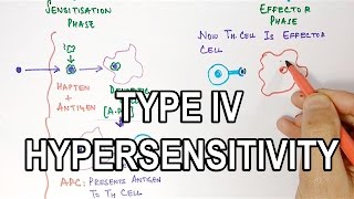 Type IV Hypersensitivity [upl. by Twum775]