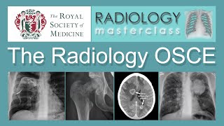 The Radiology OSCE [upl. by Akeenahs]