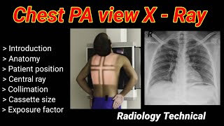 Chest PA View XRay  Posterior to Anterior view  part 1   By BL Kumawat [upl. by Murvyn]