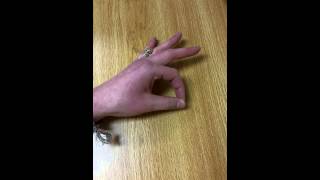 Anterior Interosseous Nerve Test [upl. by Halehs473]