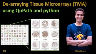 343 Dearraying Tissue Microarrays TMA using Qupath and python code [upl. by Rukna]