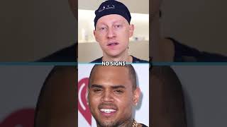 Did Chris Brown Have Plastic Surgery [upl. by Jump]