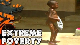 Extreme Poverty [upl. by Clywd824]