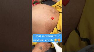 fetal movement in mother wombpregnancy periodviral [upl. by Thisbe]