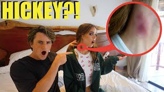 HICKEY PRANK ON MY GIRLFRIEND  EXTREME [upl. by Dupre]