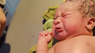 Just afterbirth a newborn baby Grunting chestBaby stomach wash afterbirth youtubeshorts [upl. by Grefer]