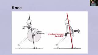 Gait Analysis II [upl. by Mehcanem609]