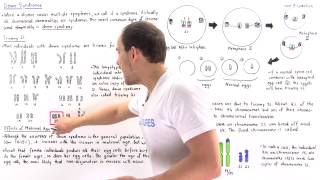 Down Syndrome Trisomy 21 and Translocation [upl. by Rocca188]