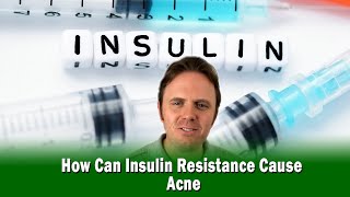 How Can Insulin Resistance Cause Acne [upl. by Islean101]