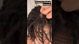 Protective Styling amp Psoriasis [upl. by Natanoj]