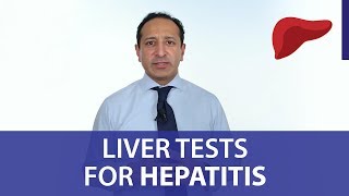 Liver Tests for Hepatitis [upl. by Lamaj792]