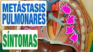 Todos los Síntomas de las Metástasis en los Pulmones [upl. by Adniles]