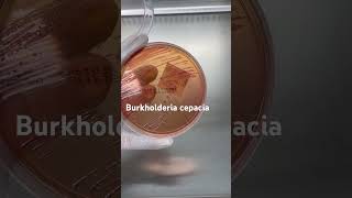 Burkholderia cepacia trên thạch MC BurkholderiaCepacia ViKhuanNguyHiem MacConkey YHoc SucKhoe [upl. by Arahk56]