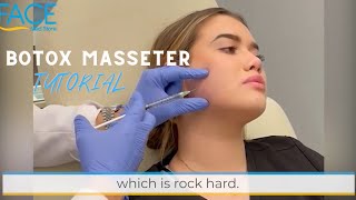 How to Inject Botox to the Masseter Muscles [upl. by Connor]