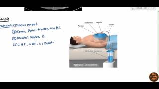 Ascites for USMLE Step 2 [upl. by Gnuh179]