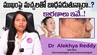 చర్మంపై నల్లటి మచ్చలు వచ్చాయా  Causes of Pigmentation in Telugu  Pelle Skin amp Hair Clinics [upl. by Carroll]