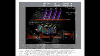 Ecografía Doppler Obstetrico Libro [upl. by Isleen116]