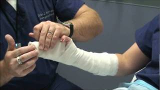 Splint Workshop 3  Ulnar Gutter Splint [upl. by Adnana]