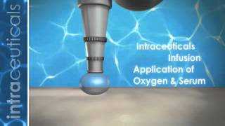 INTRACEUTICALS MADONNAS OXYGEN FACIAL MACHINE [upl. by Aitetel]