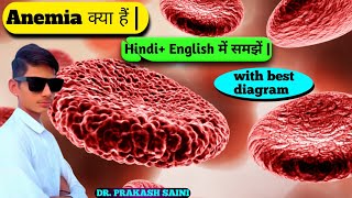 Anemia क्या हैं  typescausessymptomstreatments 👈  Hindi and English dono में समझें 👍😲🤔 [upl. by Kelly331]