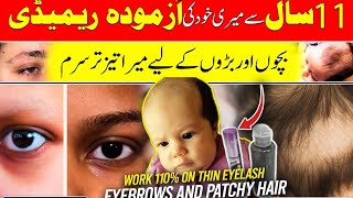 11 Saal Se Azmuda DESI Serum  Fast Eyebrow amp Eyelash Growth  Bald Patches Ke Liye BEST SOLUTION [upl. by Nostets]