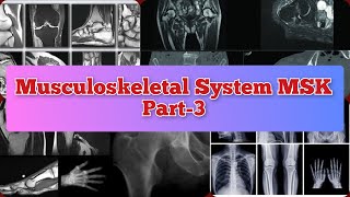 Radiology Viva Cases  7882  Musculoskeletal System Part3  MSK medical radiology ultrasound [upl. by Fried]