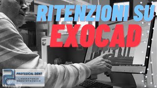 Ritenzioni con Exocad [upl. by Llezniuq]