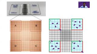 Counting cells on a hemocytometer [upl. by Lac224]