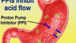 Esomeprazole Nexium [upl. by Nirraj]