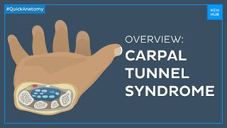 Carpal tunnel syndrome Symptoms causes treatment  Quick Anatomy  Kenhub [upl. by Hillary]