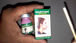 WARTOSIN Wart Remover in hindi लटकते मस्सों चामखीळ को निकालने की आयुर्वेदिक दवा amp Review [upl. by Okia864]