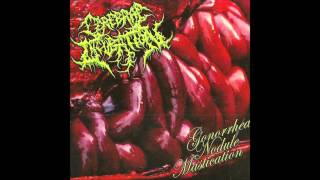 Cerebral Incubation  Gonhorrea Nodule Mastication Full Album 2012 HD [upl. by Trevah]