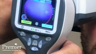 Volk Pictor Plus Retinal Camera Demonstration [upl. by Oilejor173]