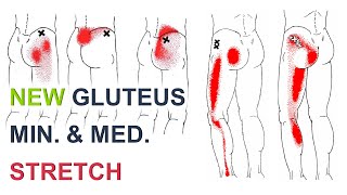 Stretches For Hip And Leg Pain  Gluteus Medius Pain [upl. by Dib]